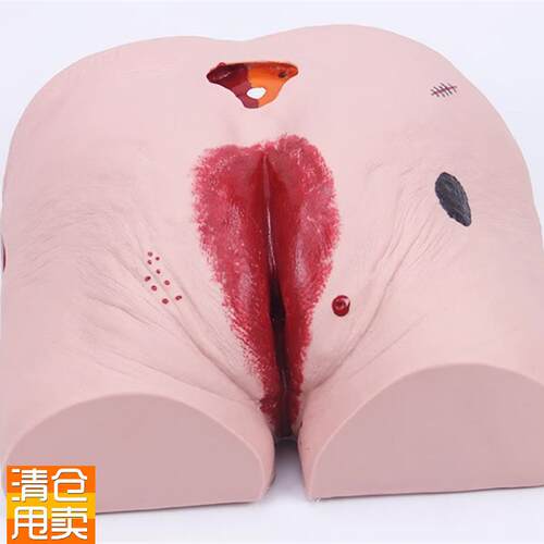 褥疮压疮b护理模型老年人褥疮压疮护理模型医学用教学模型