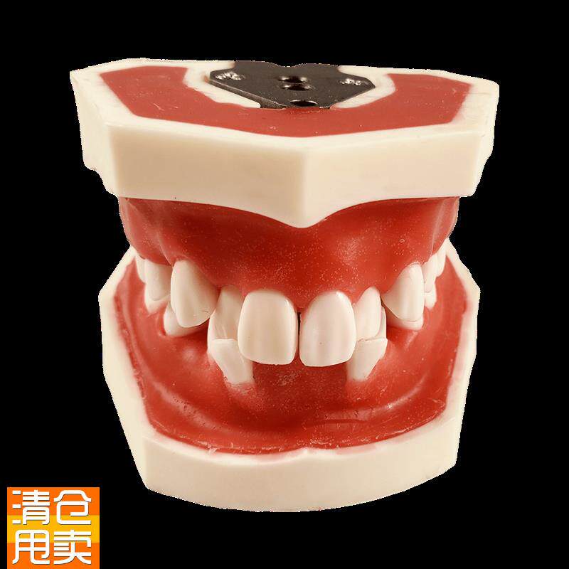 牙模型备b牙牙科口腔矫正牙周模型练习牙结石刮治软牙龈牙列不齐