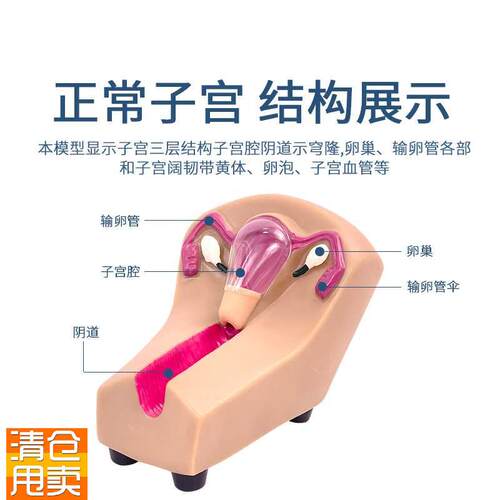 女性宫内避孕及训练模型w女性节育计生模型女性宫内避孕模型