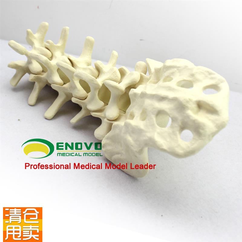 骨科术前Sawbone人体腰椎模型人工骨模O型骨科手术仿真骨演示