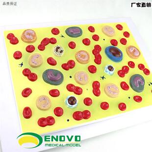 ENOVO正品医用人体血细j胞放大模型血液病学内科病理生理教学模型