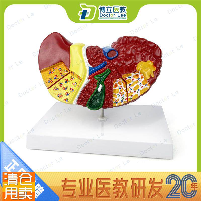 肝脏模型肝脏病理模型肝v解剖模型肝胆胰脾十二指肠消化系统