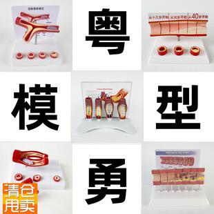 动态血管粘稠堵塞模型动支脉粥样硬化心血管支架R放大病理教学模