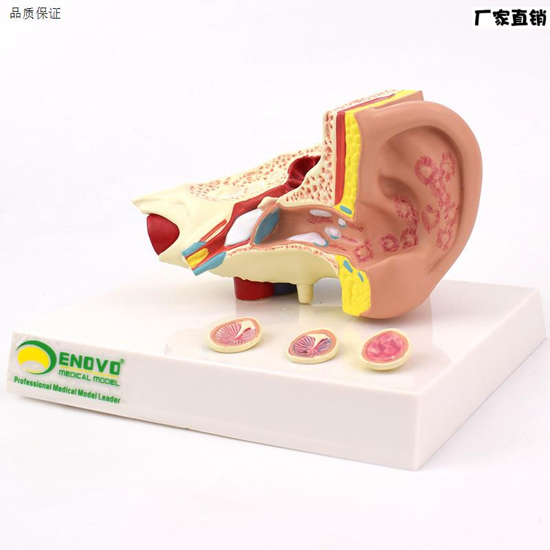 ENOVO颐v诺耳朵常见病理解剖结构模型中耳炎耳穿孔鼓膜炎耳鸣耳聋