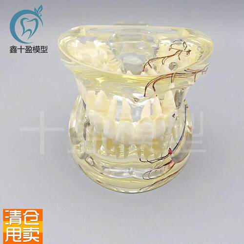 牙科水晶牙齿病h理模型M40192成人透明病理牙模型带牙神经和嵌体