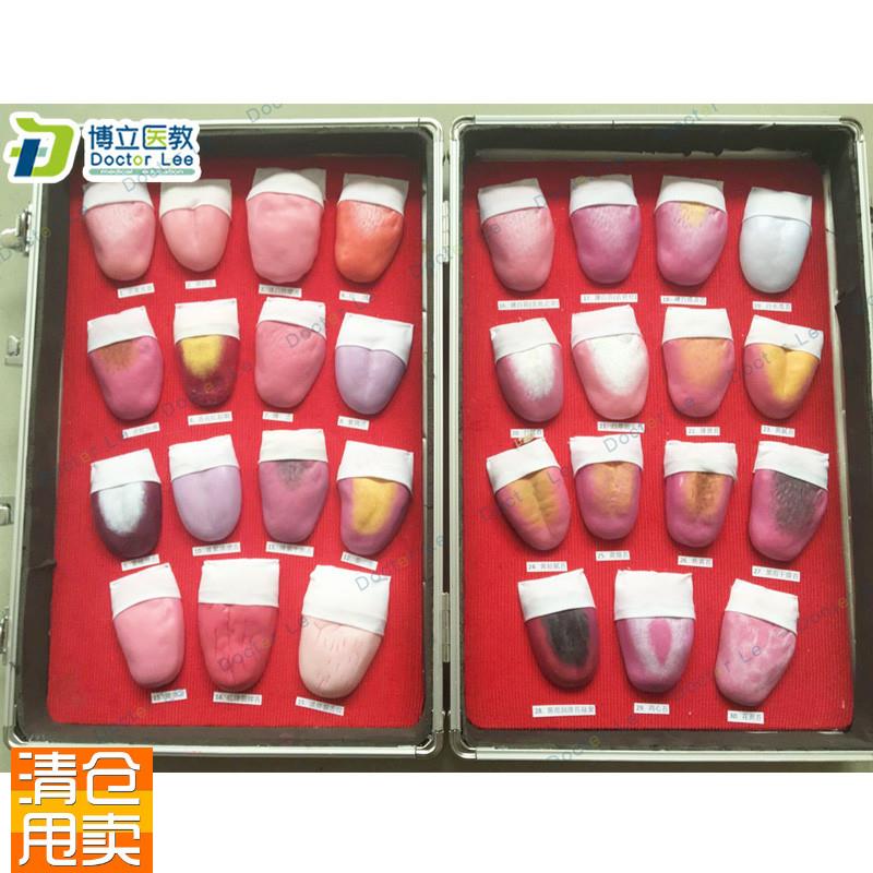 人体舌头舌苔常见病变比较模型口腔L护理医用教学人体模型