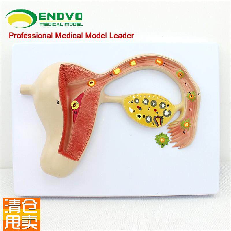 颐诺正品人体受精卵模型妊娠胚A胎儿发育过程子宫组织胚胎模型
