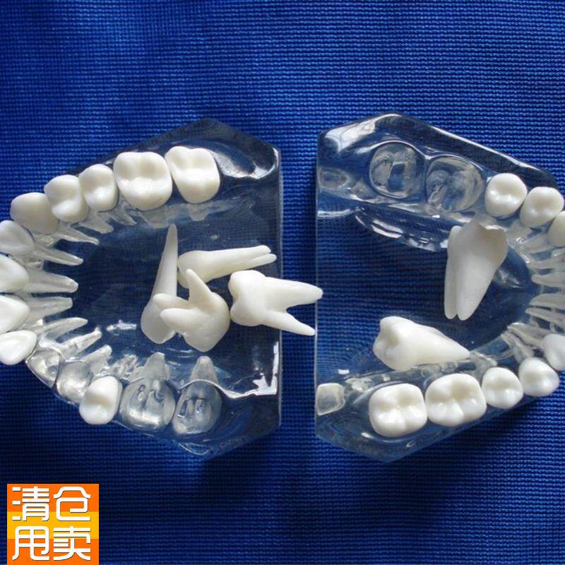 水晶透明牙模型可r拆卸拔牙练习牙齿解剖构造模型