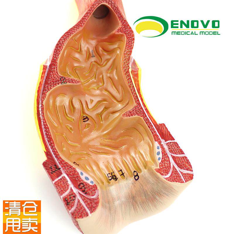ENOVO颐诺医学人体直肠肛管肛门解剖结构L模型肛肠科外科消化系统