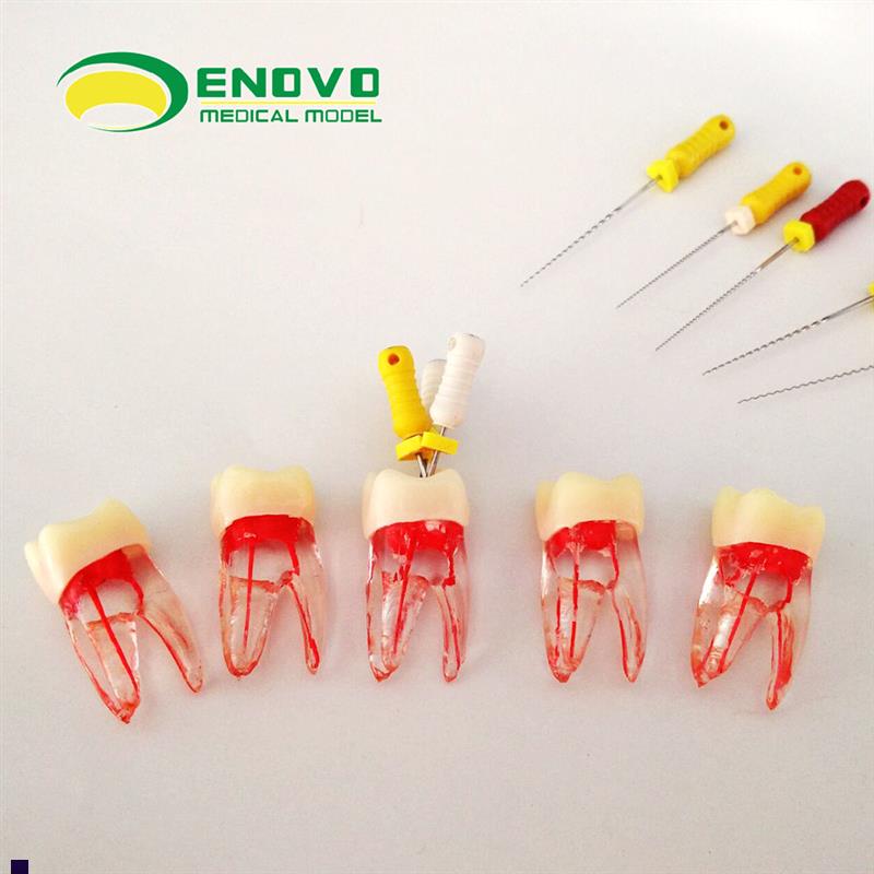 ENOVO颐诺齿科根管离体牙根管治疗练习摸拟RNCT根管教学练习牙体