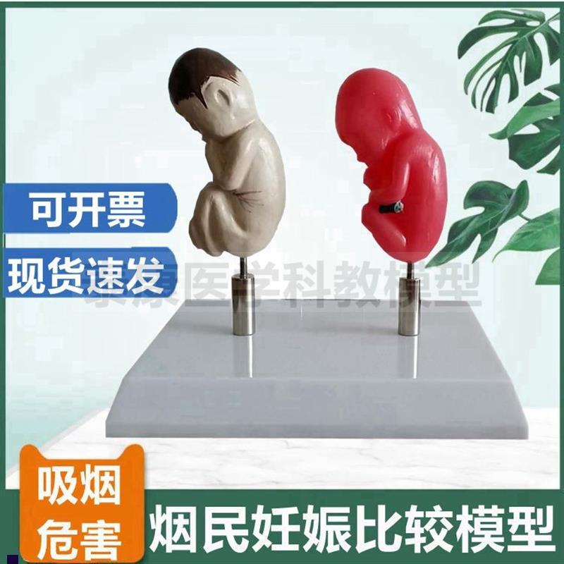 吸烟有害健康模型女性p吸烟危害胎儿畸形妊娠发育泌尿膀胱禁烟展