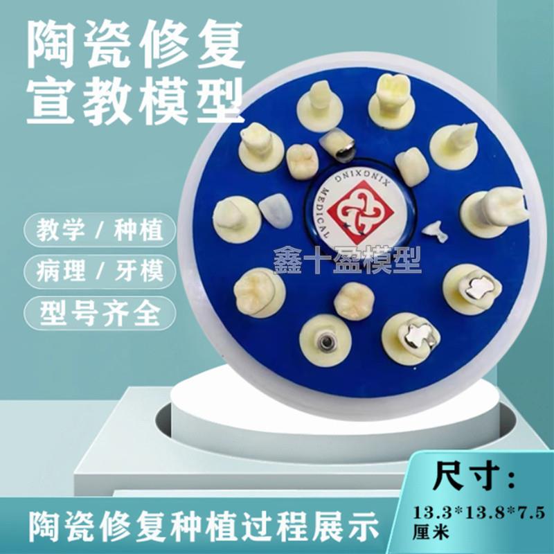 牙齿模型口腔教学陶瓷10*1仿真A修复治疗过程种植根管病理医患沟