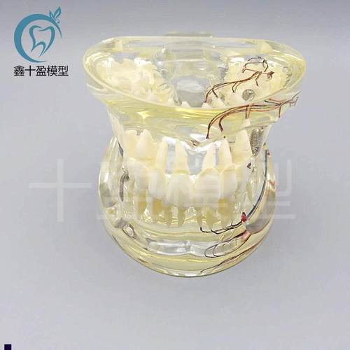 牙科水晶牙齿病理模型M4019-2成人透明病理牙S模型带牙神经和嵌体