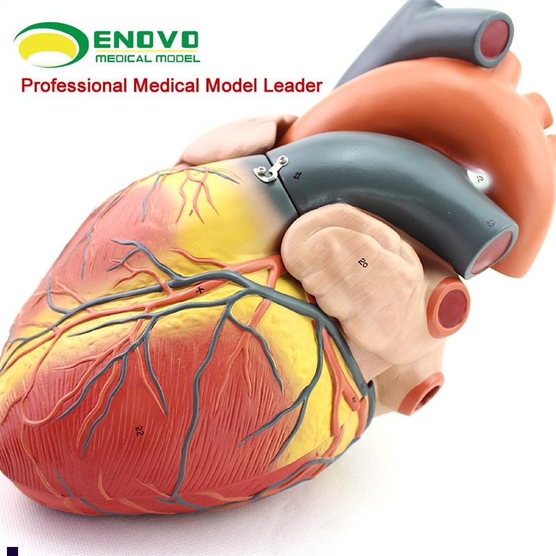 颐诺正品放大人体心脏模型Bx超彩超声医用心内科心脏解剖教学模型