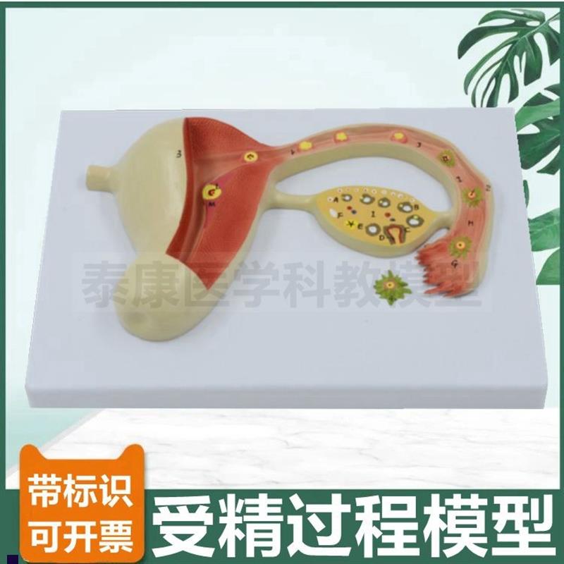 受精过程模型精子和o卵子结合生殖胚胎妊娠发育过程妇产科教学用