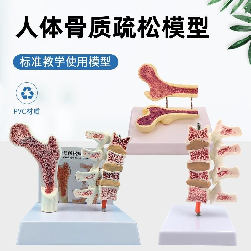 人体股骨骨质疏松解剖模型腿骨解剖B面 脊柱切面标本 病变腰椎模