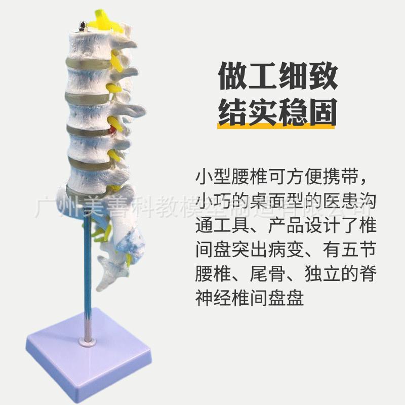 人体脊柱模型脊椎骨o腰椎模型腰椎结构腰椎间盘关节模具病理腰椎