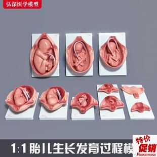 胎儿生长发育过程模型女性怀孕妊娠十月分娩M妇幼保健妇产科学1比