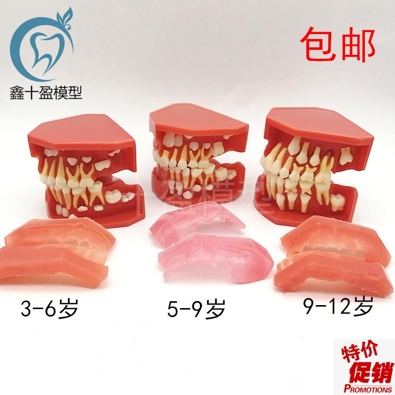 儿童乳牙替换牙齿模型乳恒牙交替3个阶段口L腔5-9髓牙列发育模型