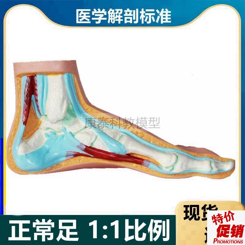 脚模型正b常扁平弓形畸形足解剖脚底功能康复足骨仿真健身教学用