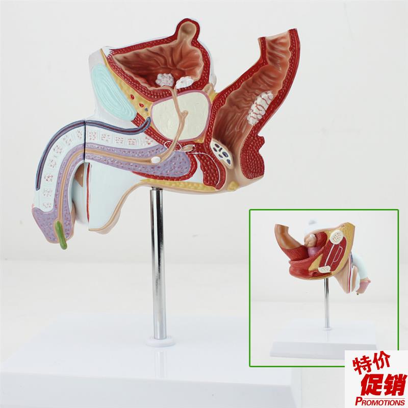 颐诺正品人体男j性生殖泌尿疾病模型男科模型淋病前列腺增生模型