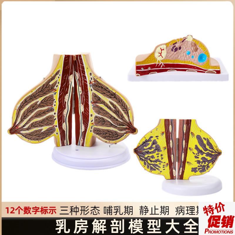 哺乳期乳房模型胸部解剖乳房结A构造乳房乳腺病变模型催乳师教具