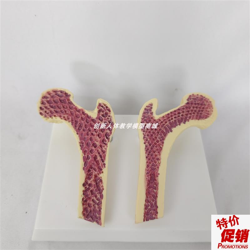 人体股骨头解剖模型骨质疏松切面解剖人I类骨骼骨架解剖医讲解教