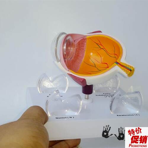 眼球疾病c眼睛解剖眼球构造角膜疾病眼球模型眼睛模型