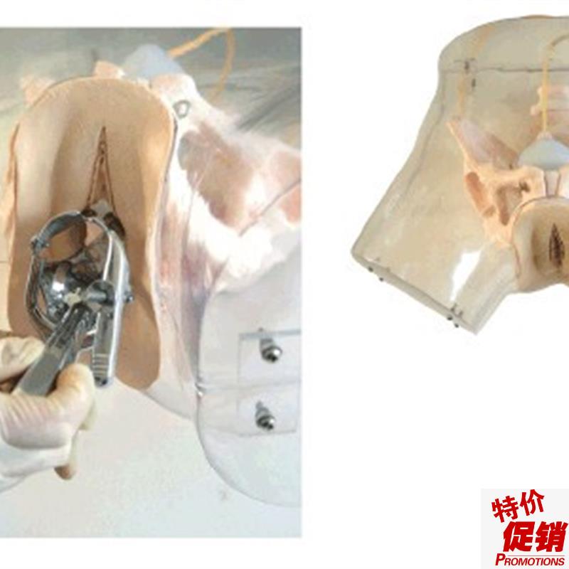 高级透明刮宫模型