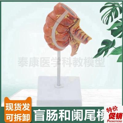 人体阑尾解剖模型回o肠盲肠胃肠消化系统病理结肠直肠肛周痔疮