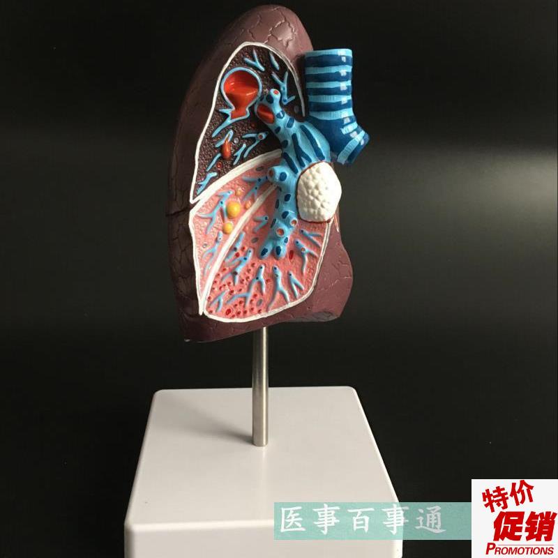 教学仿真病变肺模型病理肺解剖标本人体解K剖内脏解剖仿真医学教