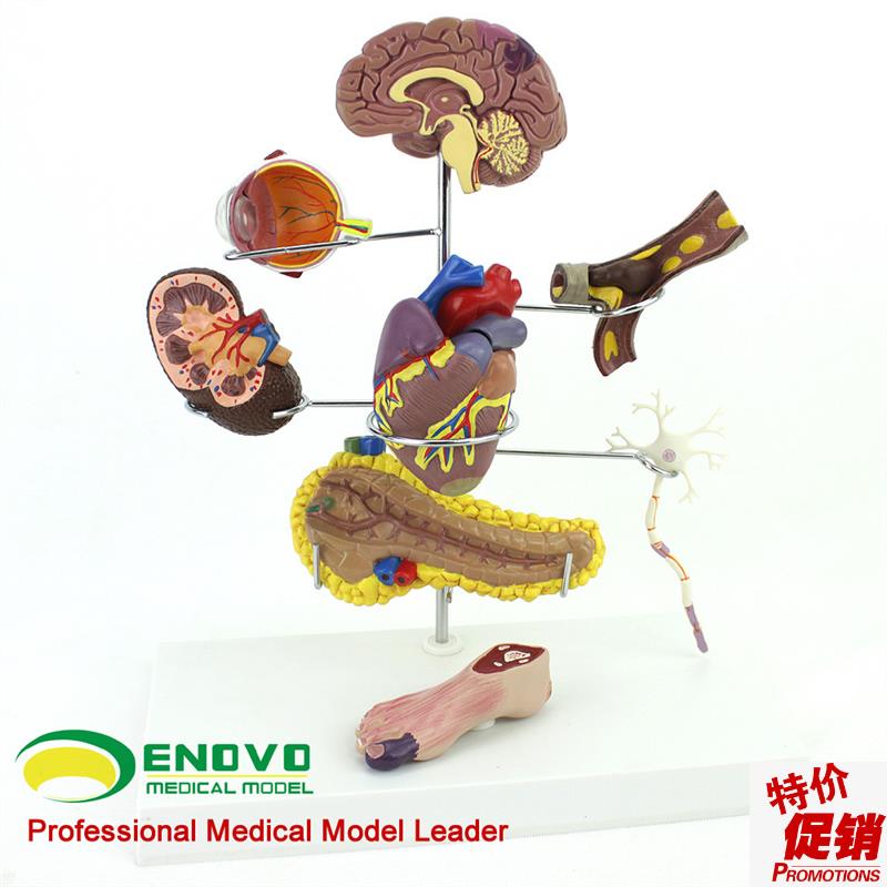 ENOVO颐诺人体医n学糖尿病模型并发症大脑心脏胰腺神经元足内外科
