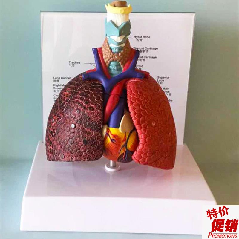 喉心肺肺段肺脏病态与健康比较解剖医用医学模S型胸外科支气管树