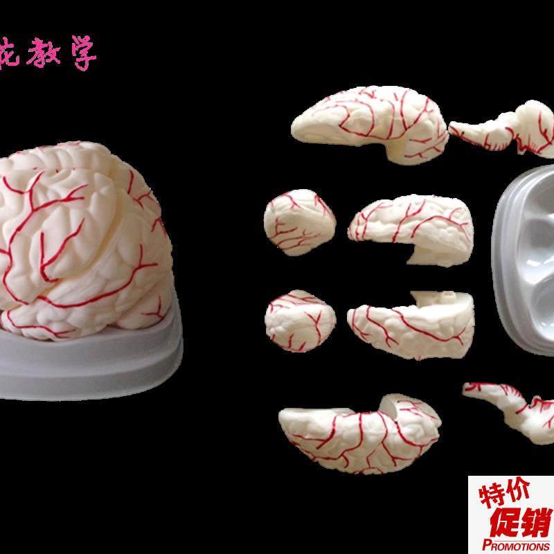 向阳花正品人脑模型脑解剖y脑动脉模型医用大脑模型包邮
