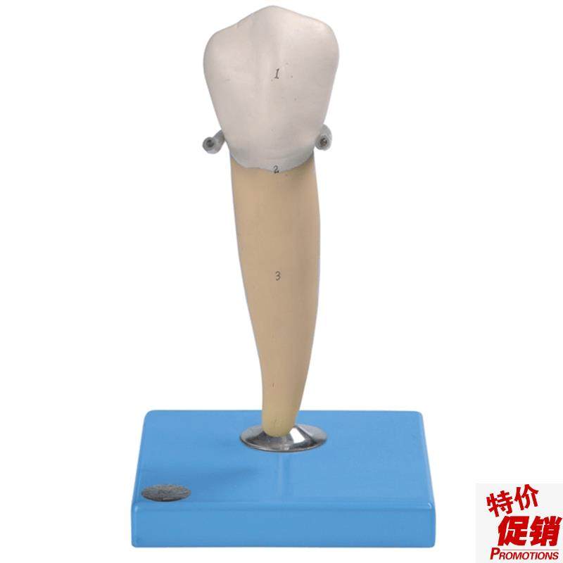 前磨牙有d一个牙根模型B10004/3