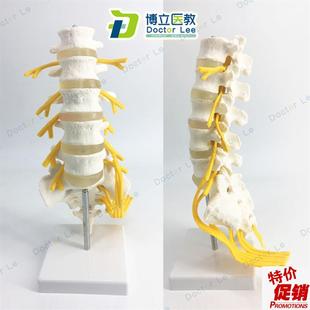 腰椎带骶骨尾骨附神经教学模型5节腰椎带骶骨.附神经模型