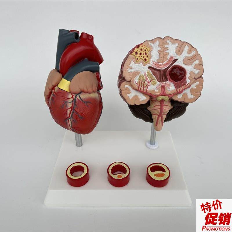 人体心脑血管展示模型血压高心脏模具I与心血管模型对比教具模型,文具电教/文化用品/商务用品,教学标本/模型,淘宝优惠券,粉丝福利购,淘宝优惠卷