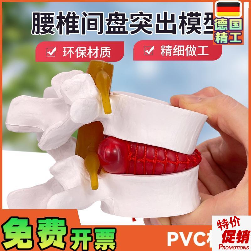 腰椎放大腰椎间盘受压演示模型人体脊柱脊椎骨病理T演示关节医学