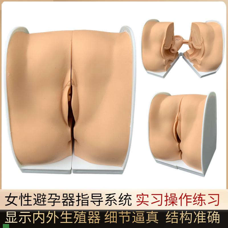 避孕指导模型女性避孕模型妇科检查模K型教学培训计划生育专用
