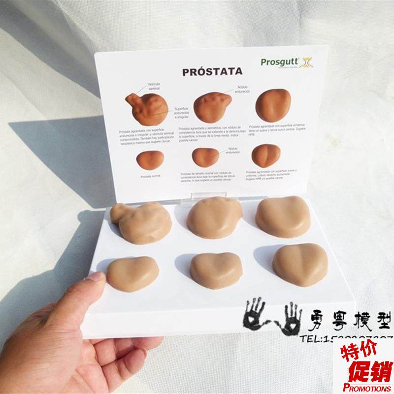 男性前列腺f模型病症前列腺模型人体模型生殖泌尿系统男科教学
