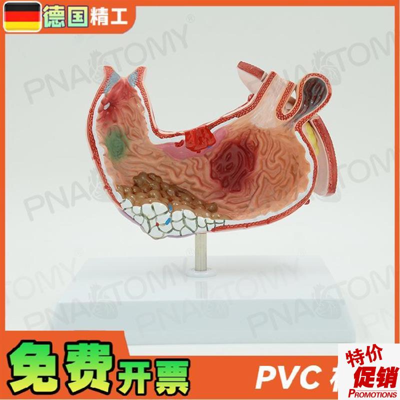 德国】人体胃结构l消化系统解剖模型病理展示标本医学内脏器官消