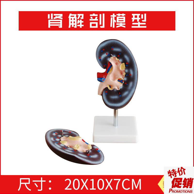 肾解剖模型2件右肾作额状切面D示肾门肾血管输尿管肾盂肾脏
