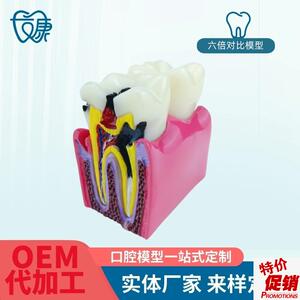 6倍对比模型牙科教学器材6倍龋齿对比I模型口腔模型教学牙齿模型