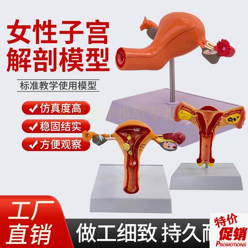 人体模型女性生殖子宫模型t阴道卵巢模型教学模具病理变化科学教