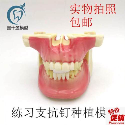 牙科口腔模型练习种植模型支抗钉练习模型K发泡仿真骨模型N2031