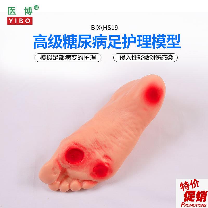 医博BIX-HS19高级糖尿病足部护理模型侵入性病变溃烂U足部护理训