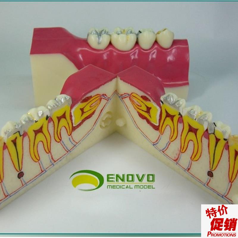 ENOVO正品右下后牙组织分y解模型牙齿解剖牙列模型口腔科教学