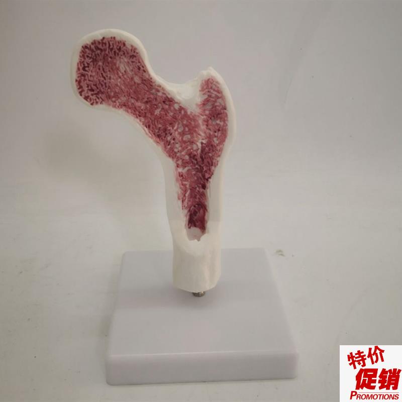 人体骨质疏松比较股骨头解剖模F型骨骼骨架医用教学讲解