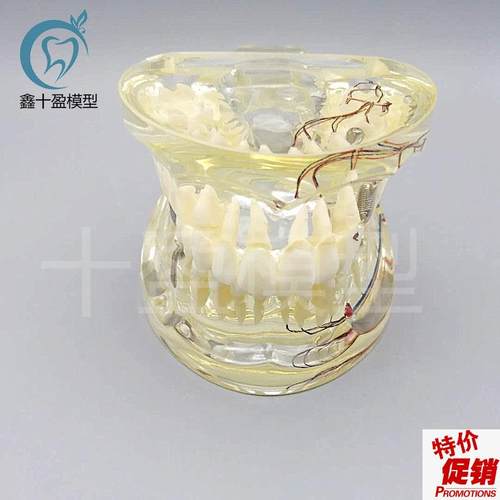 牙科水晶牙齿病理模型M4r019-2成人透明病理牙模型带牙神经和嵌体