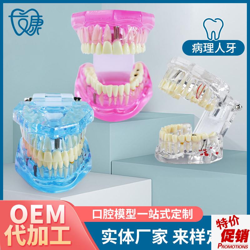 牙齿模型透明精品正常牙适合牙科医H生演示或者学生上课练习用